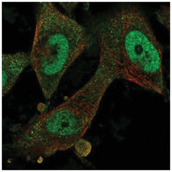 Fbx32 Antibody, Novus Biologicals:Antibodies:Primary Antibodies