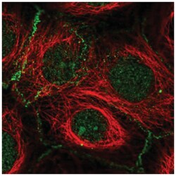 FBXL2 Antibody, Novus Biologicals 100&mu;L; Unlabeled:Antibodies, Polyclonal