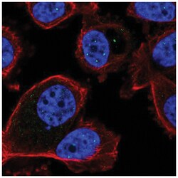 FBXL3 Antibody, Novus Biologicals 25 &mu;L, Unlabeled:Antibodies, Polyclonal
