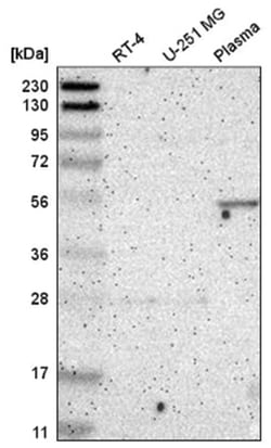 FBXL6 Antibody, Novus Biologicals 100&mu;L; Unlabeled:Antibodies, Polyclonal