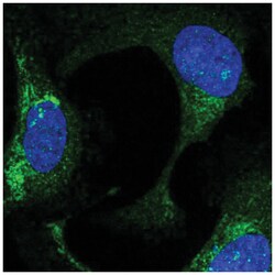 FBXO21 Antibody, Novus Biologicals 25 &mu;L:Antibodies, Polyclonal