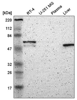 FBXO3 Antibody, Novus Biologicals 100&mu;L; Unlabeled:Antibodies, Polyclonal