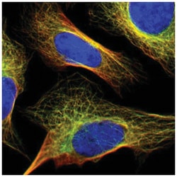 FBXO30 Antibody, Novus Biologicals 100&mu;L; Unlabeled:Antikroppar