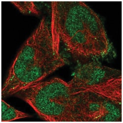 FBXO41 Antibody, Novus Biologicals 25 &mu;L, Unlabeled:Antibodies, Polyclonal