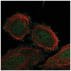 FBXO41 Antibody, Novus Biologicals:Antibodies:Primary Antibodies