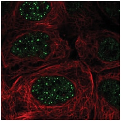 FBXO48 Antibody, Novus Biologicals 100&mu;L; Unlabeled:Antibodies, Polyclonal
