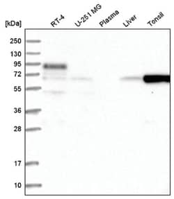 FBXO7 Antibody, Novus Biologicals 100&mu;L; Unlabeled:Antibodies, Polyclonal