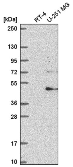FBXW11 Antibody, Novus Biologicals 100&mu;L; Unlabeled:Antibodies, Polyclonal