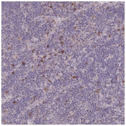 Fc epsilon RI Antibody, Novus Biologicals:Antibodies:Primary Antibodies