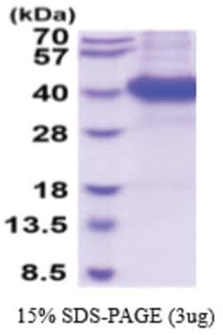 Novus Biologicals Recombinant Mouse FCRN/FCGRT Protein 50 &mu;g | Buy Online | Novus Biologicals&trade; | Fisher Scientific