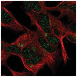 FEM1A Antibody, Novus Biologicals 25 &mu;L, Unlabeled:Antibodies, Polyclonal