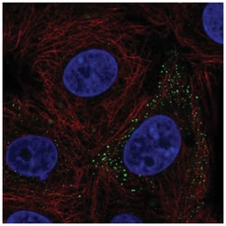 FERMT3/URP2 Antibody, Novus Biologicals 25 &mu;L, Unlabeled:Antibodies,