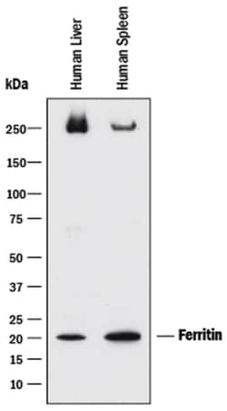 Human Ferritin Antibody, R D Systems:Antibodies:Primary Antibodies