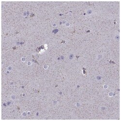 FEZF1 Antibody, Novus Biologicals 100&mu;L; Unlabeled:Antibodies, Polyclonal