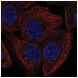 FGF-11 Antibody, Novus Biologicals 100&mu;L; Unlabeled:Antibodies, Polyclonal