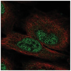 FGF-12 Antibody, Novus Biologicals 25 &mu;L, Unlabeled:Antibodies, Polyclonal