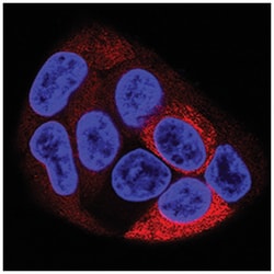 Human Fibrinogen Antibody, R D Systems:Antibodies:Primary Antibodies