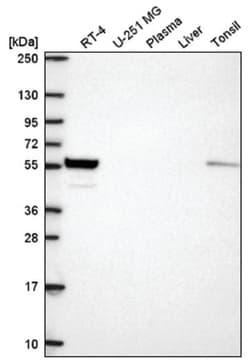 Fibulin-3/EFEMP1 Antibody, Novus Biologicals 25 &mu;L, Unlabeled:Antibodies,