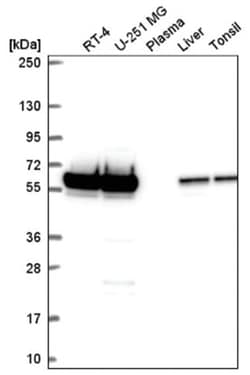 FKBP52/FKBP4 Antibody, Novus Biologicals 100&mu;L; Unlabeled:Antibodies,