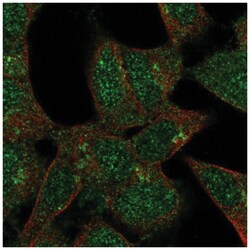 FKRP Antibody, Novus Biologicals:Antibodies:Primary Antibodies