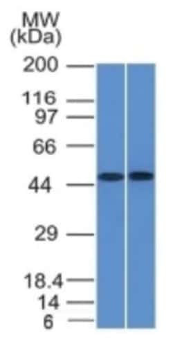 FLI1 Mouse anti-Human, Clone-FLI1/1312, Novus Biologicals:Antibodies:Primary