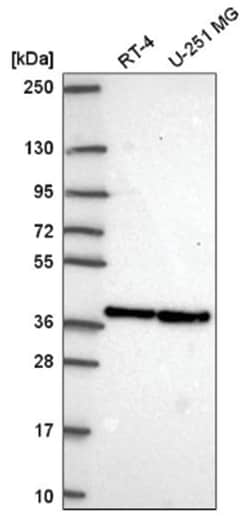 FLJ10154 Antibody, Novus Biologicals:Antibodies:Primary Antibodies