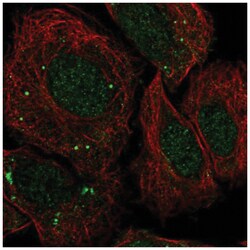 FosB/G0S3 Antibody, Novus Biologicals 100&mu;L; Unlabeled:Antibodies, Polyclonal