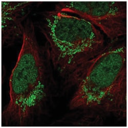 FOXB1 Antibody, Novus Biologicals 100&mu;L; Unlabeled:Antibodies, Polyclonal