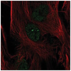 FoxC2 Antibody, Novus Biologicals 25 &mu;L, Unlabeled:Antibodies, Polyclonal