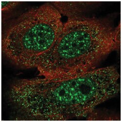 FoxJ3 Antibody, Novus Biologicals 100&mu;L; Unlabeled:Antibodies, Polyclonal