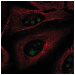 FOXL2NB Antibody, Novus Biologicals:Antibodies:Primary Antibodies