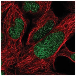 FoxP2 Antibody, Novus Biologicals 100&mu;L; Unlabeled:Antibodies, Polyclonal
