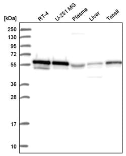 FoxP3 Antibody, Novus Biologicals 25 &mu;L, Unlabeled:Antibodies, Polyclonal