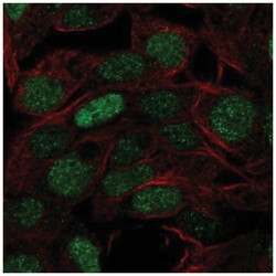 FOXQ1 Antibody, Novus Biologicals 100&mu;L; Unlabeled:Antibodies, Polyclonal