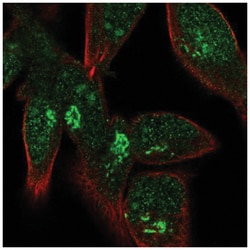 FPR1 Antibody, Novus Biologicals 100&mu;L; Unlabeled:Antibodies, Polyclonal