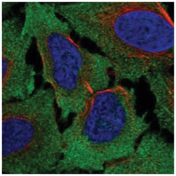 Frizzled-4 Antibody, Novus Biologicals 25 &mu;L, Unlabeled:Antibodies,