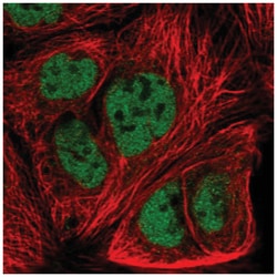 Frizzled-7 Antibody, Novus Biologicals 25 &mu;L:Antibodies, Polyclonal