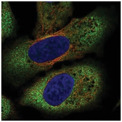 Frizzled-8 Antibody, Novus Biologicals 100&mu;L; Unlabeled:Antibodies,
