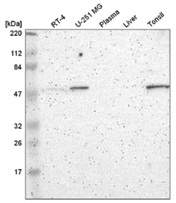 FRMD8 Antibody, Novus Biologicals:Antibodies:Primary Antibodies