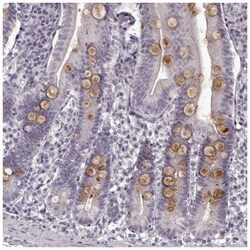 FSH beta Antibody, Novus Biologicals:Antibodies:Primary Antibodies