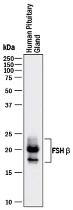 Human FSH beta Antibody, R D Systems 25 &mu;g | Buy Online | R&D Systems | Fisher Scientific