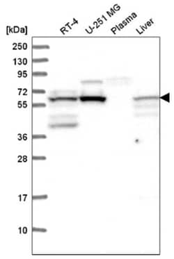 FTO Antibody, Novus Biologicals:Antibodies:Primary Antibodies