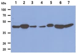 Fumarase Mouse anti-Human, Clone: 3F6, Novus Biologicals:Antibodies:Primary