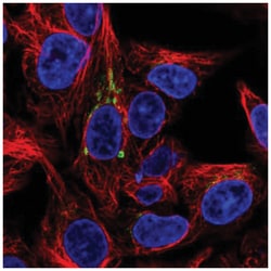 FUT6 Antibody, Novus Biologicals 100&mu;L; Unlabeled:Antibodies, Polyclonal