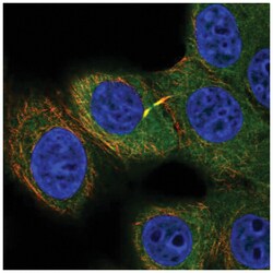 FUT9 Antibody, Novus Biologicals 25 &mu;L, Unlabeled:Antibodies, Polyclonal