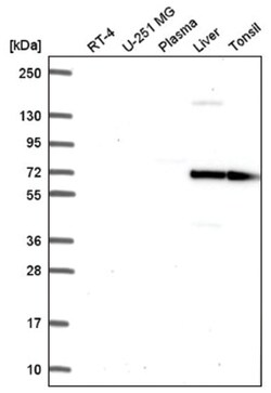 Fyn Antibody, Novus Biologicals 25 &mu;L, Unlabeled:Antibodies, Polyclonal
