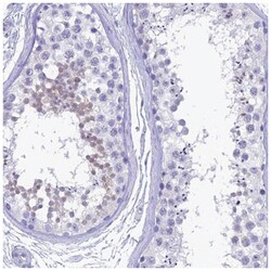 G gamma14 Antibody, Novus Biologicals 100&mu;L; Unlabeled:Antibodies, Polyclonal
