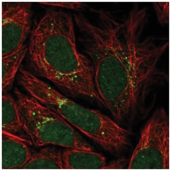 G5pr Antibody, Novus Biologicals 100&mu;L; Unlabeled:Antibodies, Polyclonal