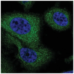 G6PC3 Antibody, Novus Biologicals:Antibodies:Primary Antibodies