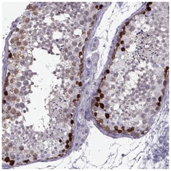 GAGE1 Antibody, Novus Biologicals:Antibodies:Primary Antibodies
